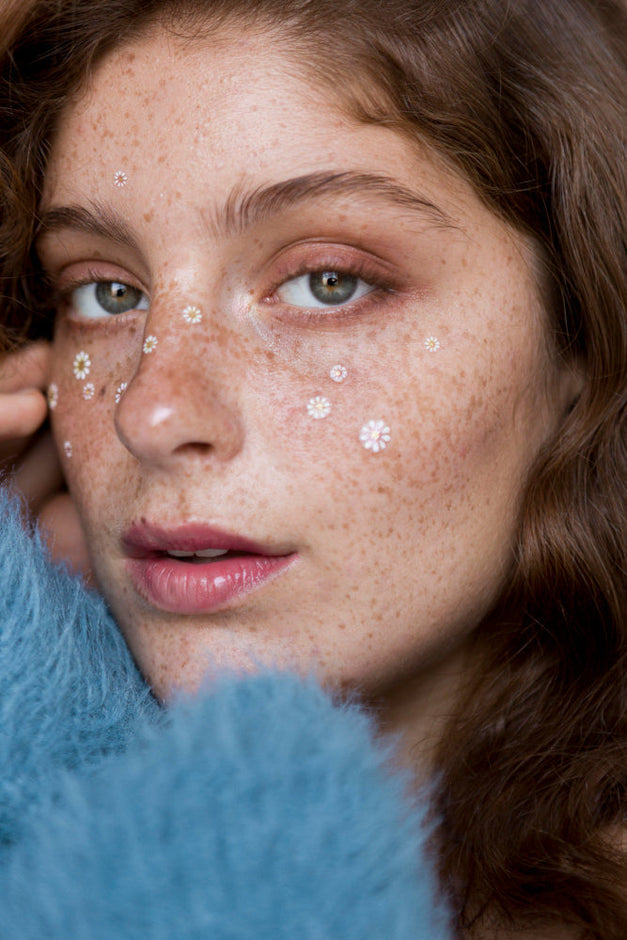 Akne Neden Oluşur? — Akneyle Baş Etmenin Bilimsel Yolları